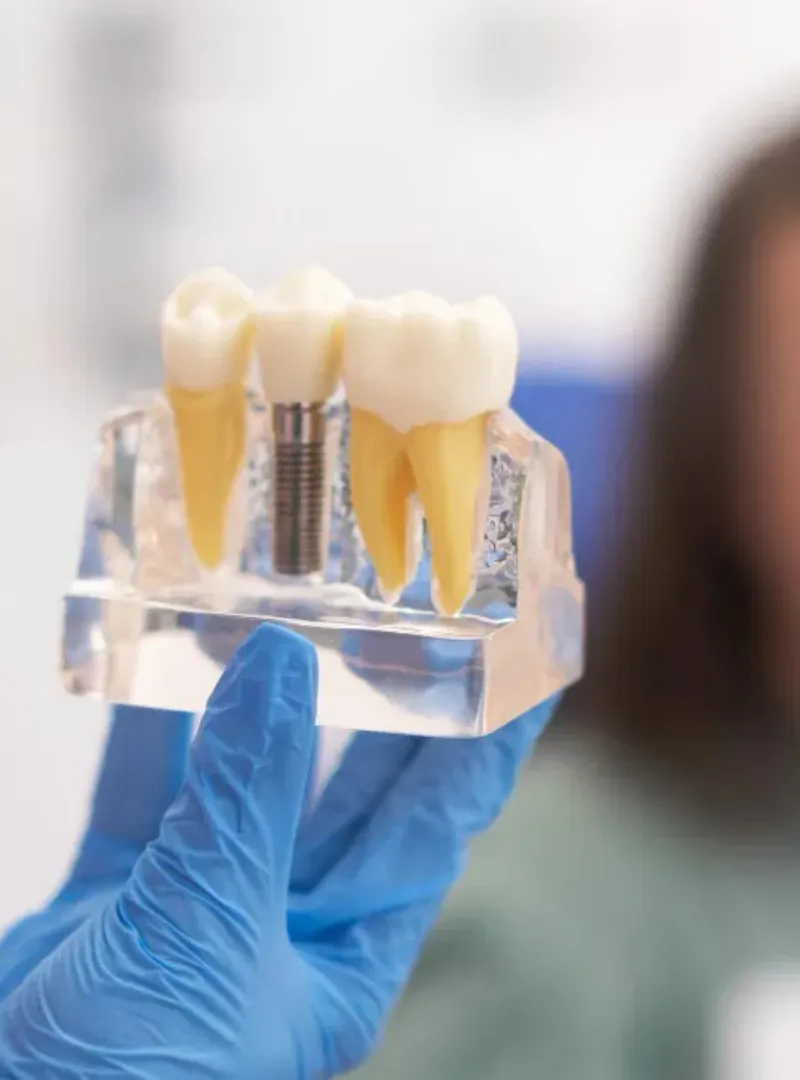 cluster implantes 2
