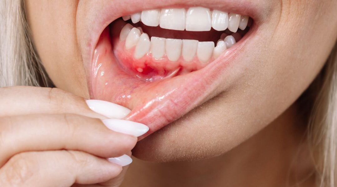 El color de las encías: qué significa y cuándo acudir al dentista