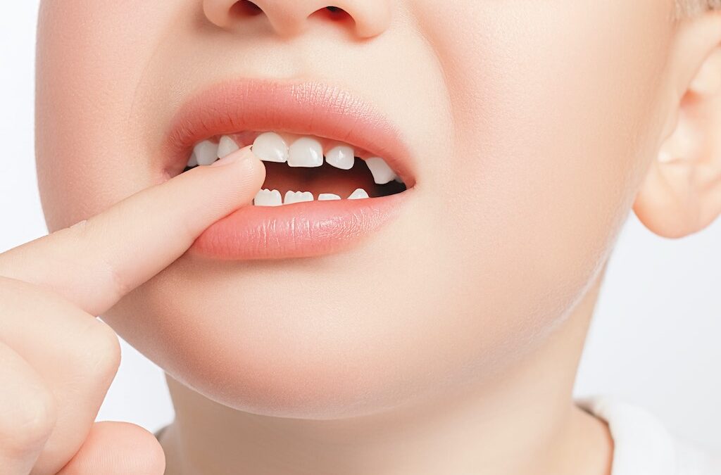 Todo lo que debes saber sobre los dientes de leche