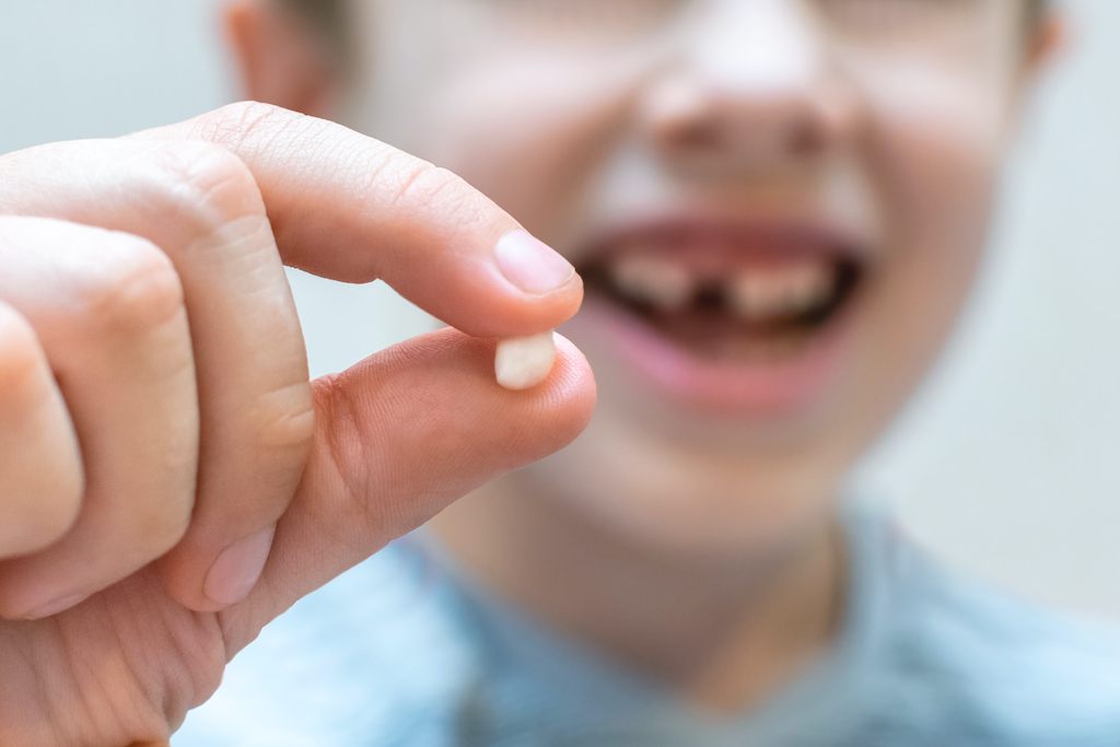 cuantos dientes leche