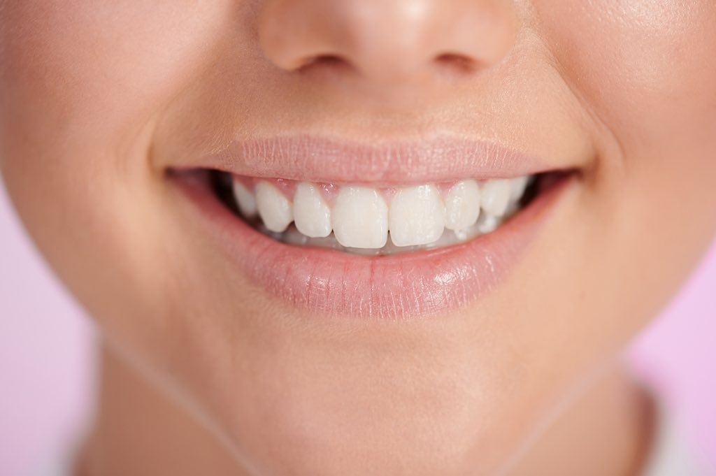 que son dientes incisivos