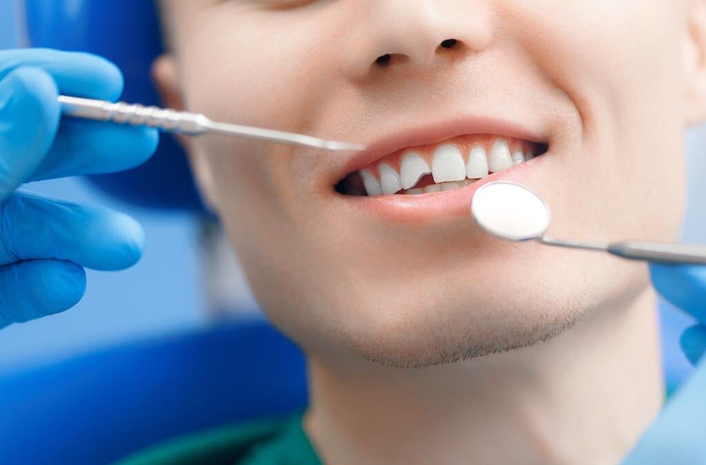 ¿Qué son las fisuras dentales y como resolverlas?
