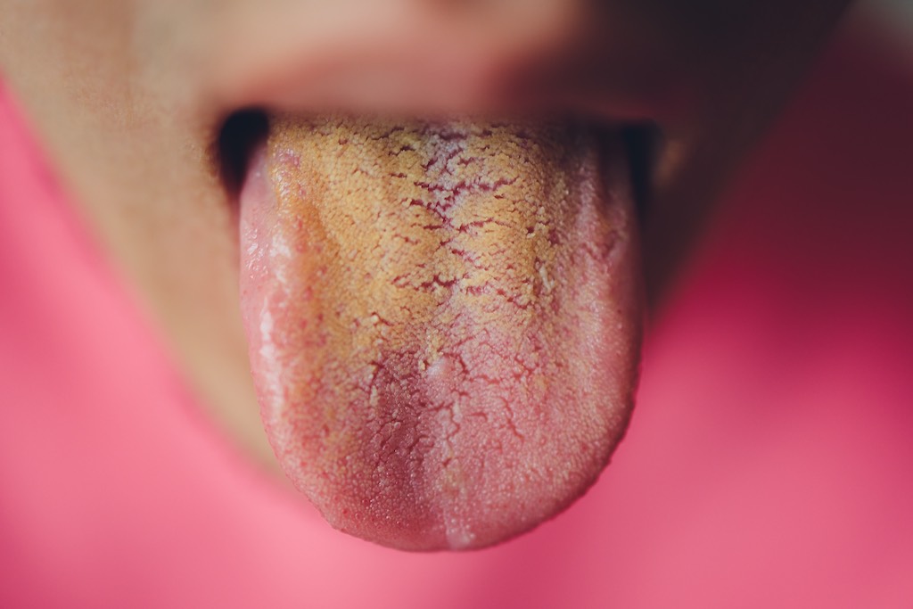 lengua amarilla