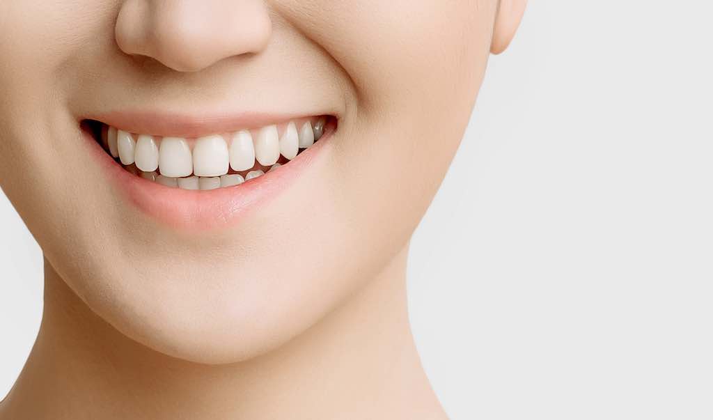 Descubre las microcarillas dentales
