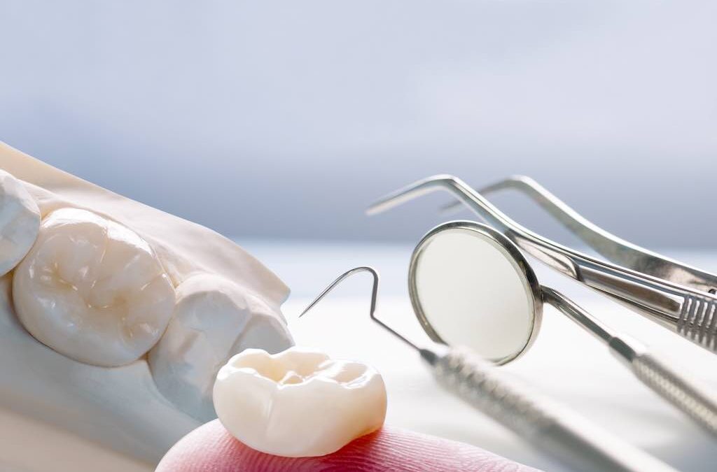 Puentes dentales: usos y tipos