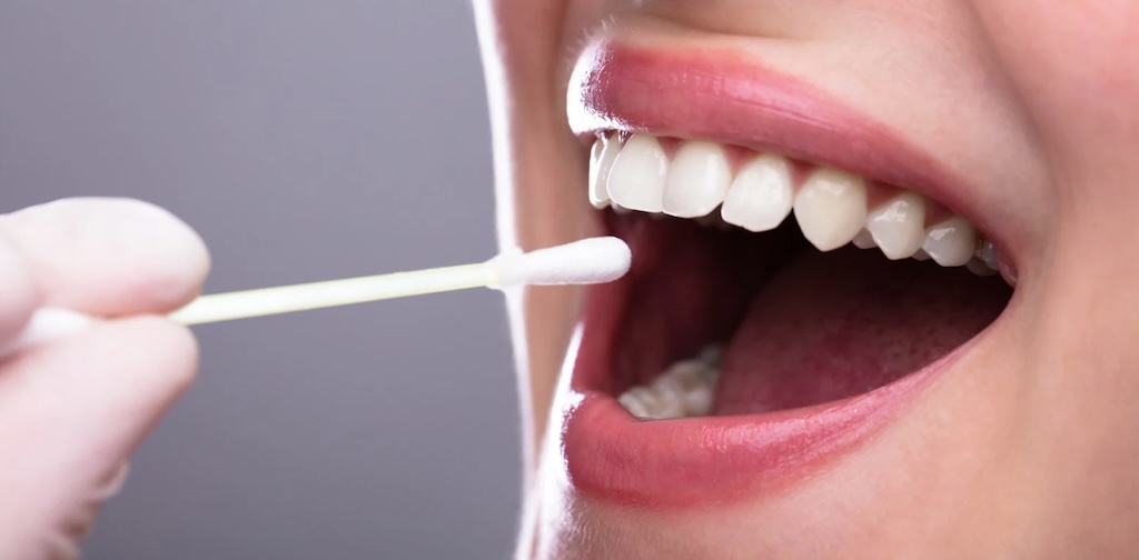 Saliva espesa: causas, síntomas, remedios y tratamiento definitivo